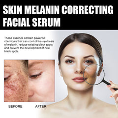 Facial Melanin Repair Hydrating