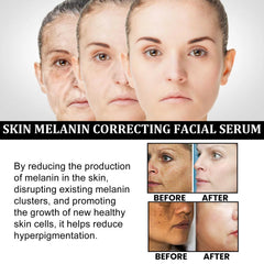 Facial Melanin Repair Hydrating